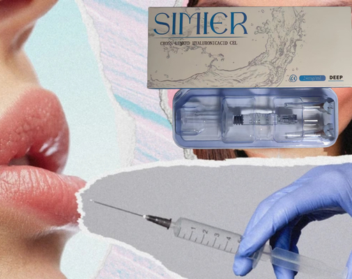SIMIER 2 ml Αντι- ρυτίδες Ενέσιμο δερματικό γεμιστήρα με υαλουρονικό οξύ για το πρόσωπο