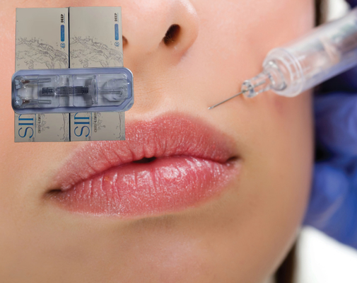 5 ml 10 ml Αντιγηραντικό Υαλουρονικό οξύ για ενέσεις στο πρόσωπο 24 mg/ ml