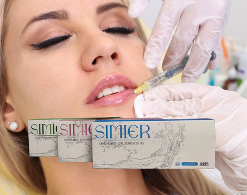Εναλλακτικά συνδεδεμένα 5ml 30mg/ ml Πηγούνι Υαλουρονικό οξύ Ενέσιμη Αντι ρυτίδες