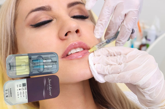Βαθιά 2ml 1ml Υαλουρονικό οξύ Γεμμένα χείλη Γυναικεία Ενέσιμα OEM ODM