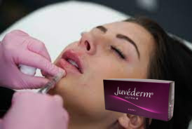 Juvederm Ultra3 2x1ml Υαλουρονικό οξύ