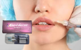 1 ml / κουτί Ενέσιμα γεμίσματα χειλιών πηγούνια πηγούνια Περσικό συνδεδεμένο γεμίσμα HA
