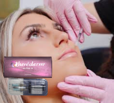 2x1ml HA Dermal Filler Γάντια και Πηγούνι