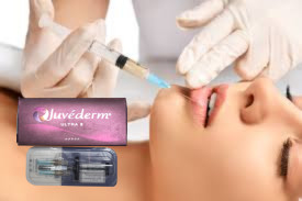 2x1ml HA Dermal Filler Γάντια και Πηγούνι