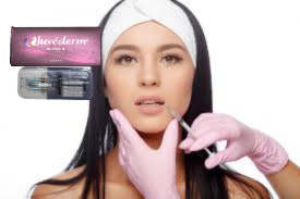 Juvederm Ultra 3 Ultra 4 Υαλουρονικό οξύ για τη βελτίωση των χειλιών