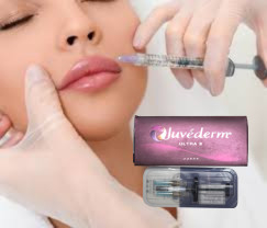 2 X 1 ml Juvederm Ultra 4 Ενέσιμα δερματικά συμπληρώματα