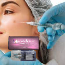 Ultra3 Ενέσιμα Χυαλουρονικό Gel Juvederm Δερμικό Γεμιστήρα για Γεμιστήρες χειριών
