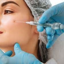 Ιαλουρονικό οξύ Juvederm Ultra 3 2*1ml
